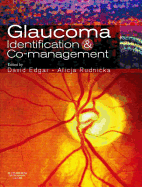 Glaucoma Identification and Co-Management