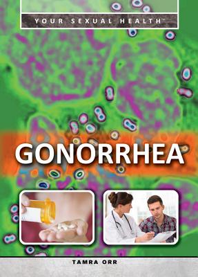 Gonorrhea - Orr, Tamra B