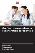 Greffes osseuses dans la r?g?n?ration parodontale