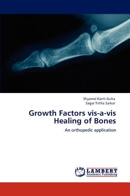 Growth Factors vis-a-vis Healing of Bones - Guha, Shyamal Kanti, and Sarkar, Sagar Tirtha
