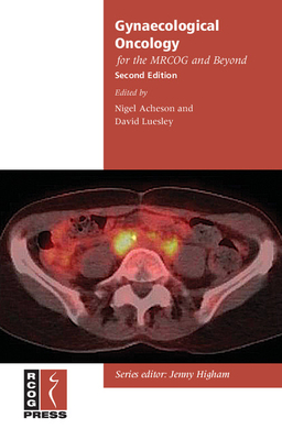 Gynaecological Oncology for the MRCOG and Beyond - Acheson, Nigel (Editor), and Luesley, David (Editor)