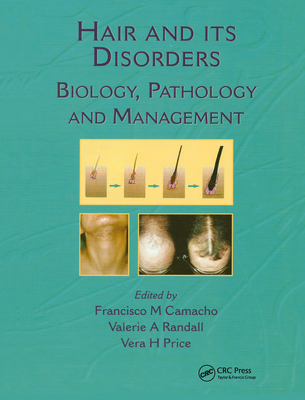 Hair and Its Disorders: Biology, Pathology and Management - Camacho, Francisco M, and Price, Vera H, M.D., and Randall, Valerie A