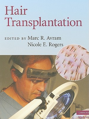 Hair Transplantation - Avram, Marc R, and Rogers, Nicole E (Editor)