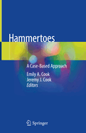 Hammertoes: A Case-Based Approach