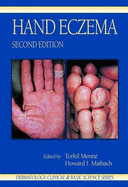 Hand Eczema, Second Edition