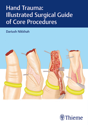 Hand Trauma: Illustrated Surgical Guide of Core Procedures - Nikkhah, Dariush