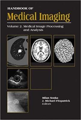 Handbook Of Medical Imaging, Volume 2: Medical Image Processing And Analysis - Fitzpatrick, J. Michael, and Sonka, Milan