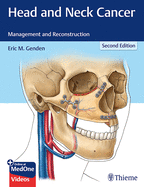 Head and Neck Cancer: Management and Reconstruction