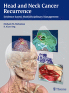 Head and Neck Cancer Recurrence: Evidence-based, Multidisciplinary Management