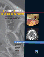 Head and Neck Cancer: State of the Art Diagnosis, Staging, and Surveillance