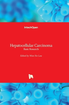 Hepatocellular Carcinoma: Basic Research - Lau, Joseph W Y (Editor)