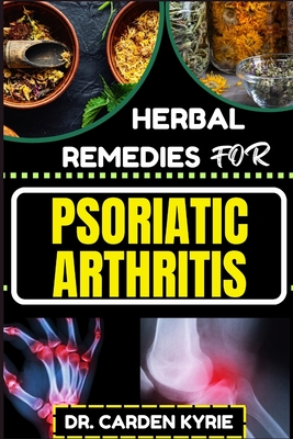 Herbal Remedies for Psoriatic Arthritis: Empower Your Journey To Wellness With Herbs For Alleviating Pain, Restoring Joint Health And Nurturing Overall Well-Being - Kyrie, Carden, Dr.