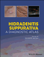 Hidradenitis Suppurativa: A Diagnostic Atlas