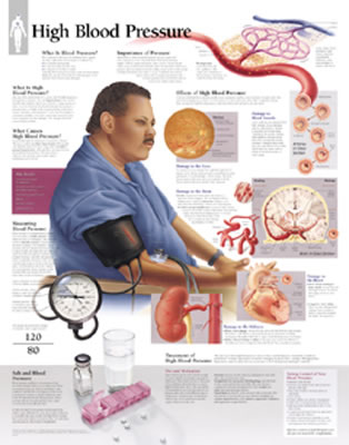 High Blood Pressure - Scientific Publishing