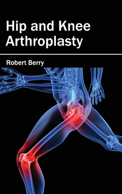 Hip and Knee Arthroplasty - Berry, Robert (Editor)