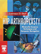 Hip Arthroplasty: Minimally Invasive Techniques and Computer Navigation, Text with DVD-ROMs - Dorr, Lawrence D