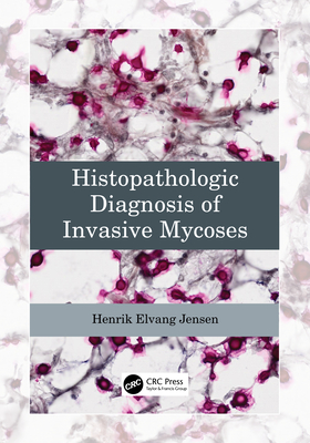 Histopathologic Diagnosis of Invasive Mycoses - Jensen, Henrik Elvang