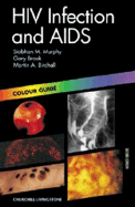 HIV Infection and AIDS: Colour Guide