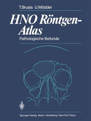 Hno Rntgen-Atlas: Pathologische Befunde - Brusis, Tilman, and Friedmann, G (Foreword by), and Mdder, Ulrich