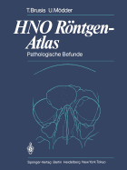 Hno Rontgen-Atlas: Pathologische Befunde