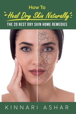 How to Heal Dry Skin Naturally: The 20 Best Dry Skin Home Remedies - Ashar, Kinnari