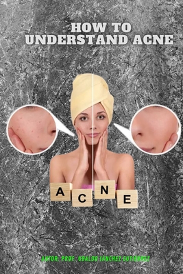 How to understand Acne - Gutirrez, Ubaldo Snchez