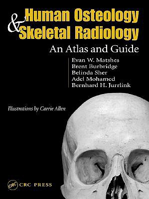 Human Osteology and Skeletal Radiology: An Atlas and Guide - Matshes, Evan W, and Juurlink, Bernard