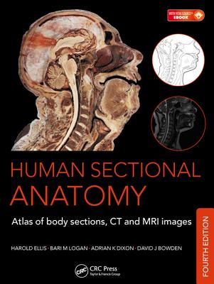 Human Sectional Anatomy: Atlas of Body Sections, CT and MRI Images, Fourth Edition - Dixon, Adrian K, MD, Frcp, Frcs, and Bowden, David J, and Ellis, Harold