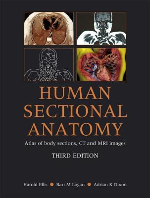 Human Sectional Anatomy: Atlas of Body Sections, CT and MRI Images - Ellis, Harold, and Logan, Bari M, Hon., Ma, and Dixon, Adrian