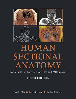 Human Sectional Anatomy Pocket Atlas of Body Sections, CT and MRI Images - Ellis, Harold, and Logan, Bari, and Dixon, Adrian