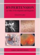 Hypertension: An Atlas of Investigation and Diagnosis