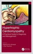 Hypertrophic Cardiomyopathy: A Practical Guide to Diagnosis and Management