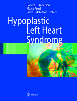 Hypoplastic Left Heart Syndrome - Anderson, Robert H, and Pozzi, Marco, and Hutchinson, Suzie