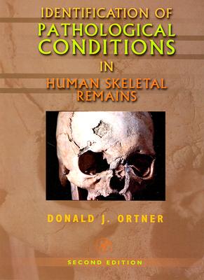 Identification of Pathological Conditions in Human Skeletal Remains - Ortner, Donald J