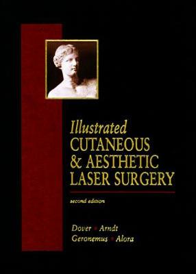 Illustrated Cutaneous & Aesthetic Laser Surgery - Dover, Jeffery S, and Geronemus, Roy G, and Arndt, Kenneth A, Dr.