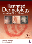 Illustrated Dermatology: Including Skin of Colour