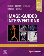 Image-Guided Interventions: Expert Radiology Series