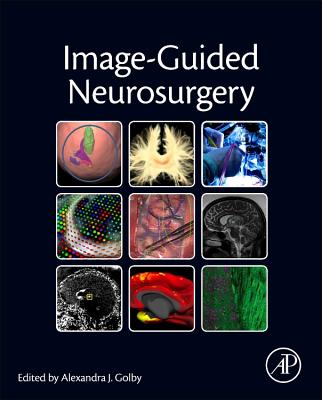 Image-Guided Neurosurgery - Golby, Alexandra J. (Editor)