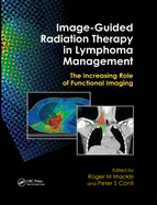 Image-Guided Radiation Therapy in Lymphoma Management: The Increasing Role of Functional Imaging