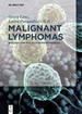 Malignant Lymphomas