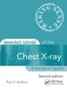 Making Sense of the Chest X-Ray