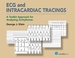 Ecg and Intracardiac Tracings