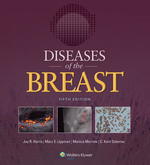 Diseases of the Breast