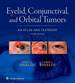 Eyelid, Conjunctival, and Orbital Tumors: an Atlas and Textbook