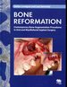 Bone Reformation: Contemporary Bone Augmentation Procedures in Oral and Maxillofacial Implant Surgery