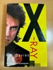 X-Ray