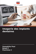 Imagerie des implants dentaires