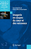 Imagerie En Coupes Du Coeur Et Des Vaisseaux: Compte Rendu Des 4es Rencontres de La Sfc Et de La Sfr, Paris, 24 Et 25 Mars 2011