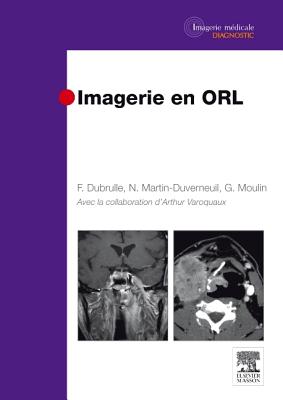 Imagerie En Orl - Dubrulle, Fr?d?rique, and Martin-Duverneuil, Nadine, and Moulin, Guy