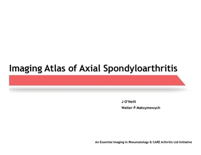 Imaging Atlas of Axial Spondyloarthritis - O'Neill, J, and Maksymowych, Walter